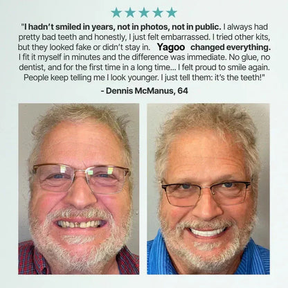 🏆Ends Today: 70% OFF! 🏆2026 Bestselling Product🦷 Fit for a Fresh Smile, Say Goodbye to Wearing Discomfort!🌎