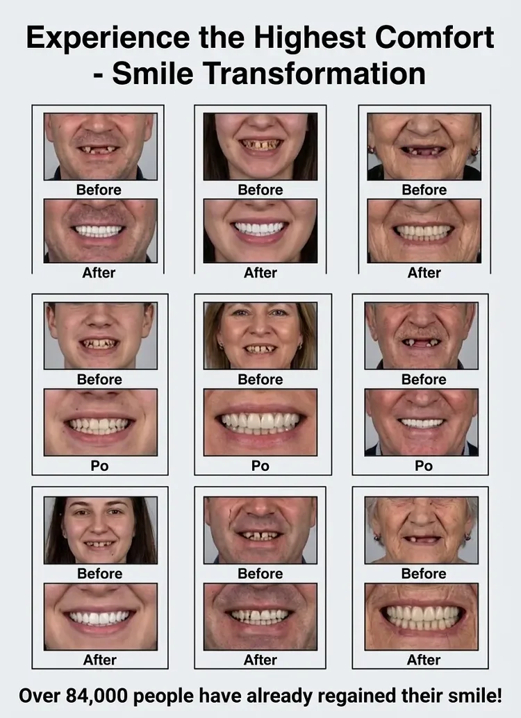 🏆Ends Today: 70% OFF! 🏆2026 Bestselling Product🦷 Fit for a Fresh Smile, Say Goodbye to Wearing Discomfort!