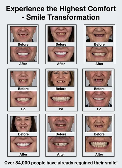 🏆Ends Today: 70% OFF! 🏆2026 Bestselling Product🦷 Fit for a Fresh Smile, Say Goodbye to Wearing Discomfort!