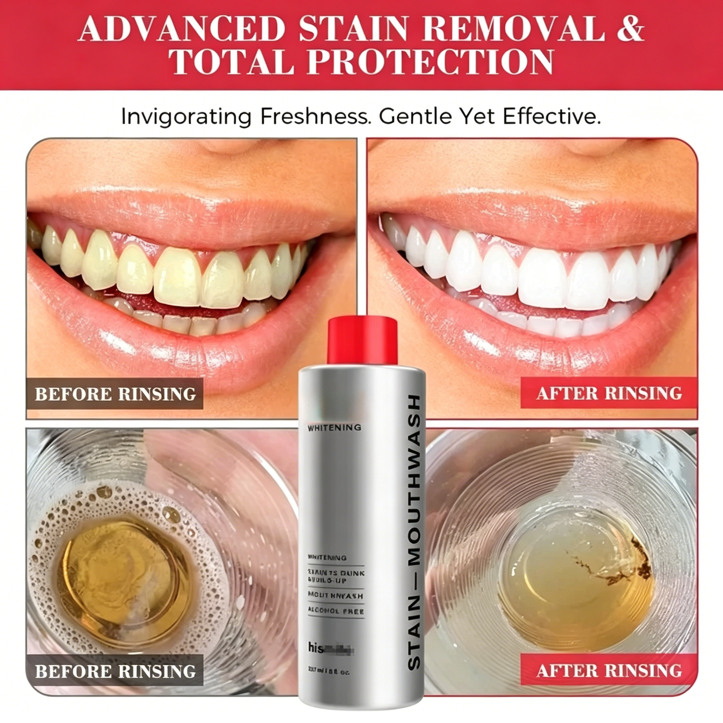 Brushing Isn’t Enough?🦷 Remove Hidden Stains & Buildup for a Brighter, Cleaner Smile👄