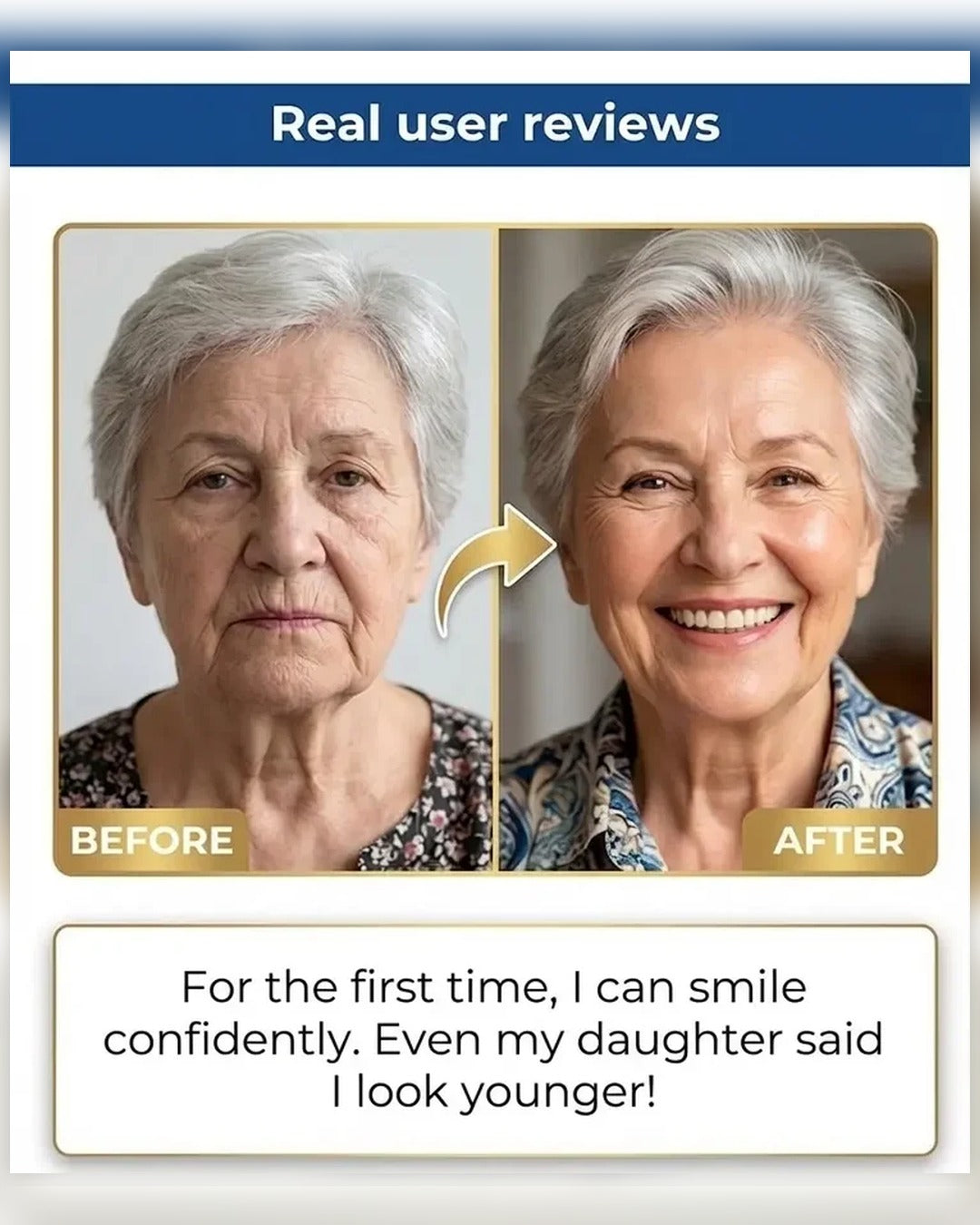 🏆Ends Today: 70% OFF! 🏆2026 Bestselling Product🦷 Fit for a Fresh Smile, Say Goodbye to Wearing Discomfort!