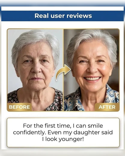 🏆Ends Today: 70% OFF! 🏆2026 Bestselling Product🦷 Fit for a Fresh Smile, Say Goodbye to Wearing Discomfort!
